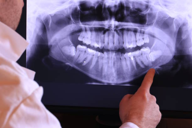 Best Emergency Treatment for Dental Infections or Abscesses in Garnet, CA