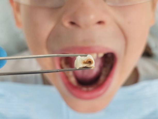 Best Weekend Emergency Dentist in Garnet, CA